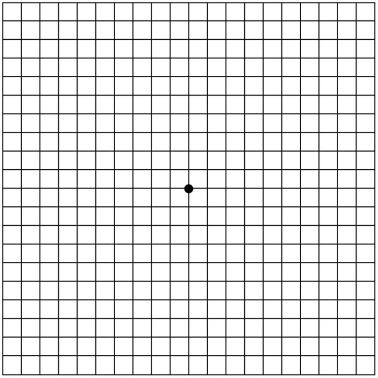 Age Related Macular Degeneration (ARMD) Cape Fear Retina